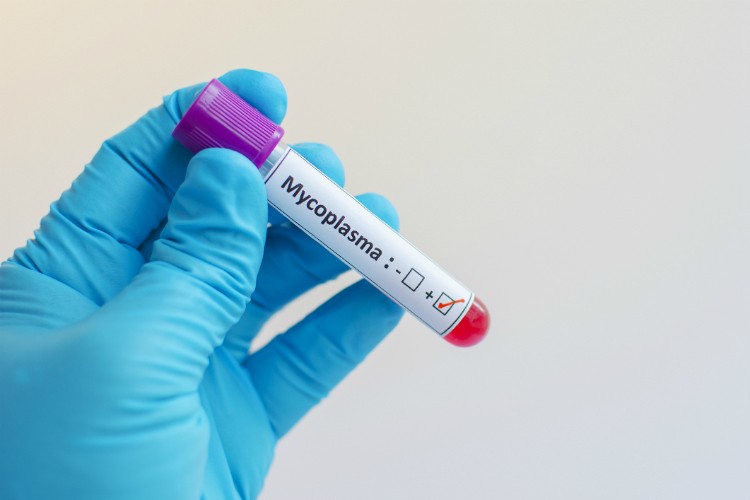 Tube d'analyse sanguine pour Mycoplasma bovine